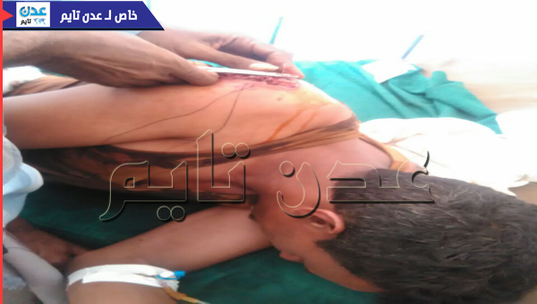 العثور علی جنود ناجين جدد من مجزرة احور (صورة جريح ناج)