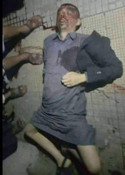 بعد مرور يوم واحد من فاعلية جماهيرية له… الحوثي يوجه ضربة موجعة للمخلوع… فهل تقترب ساعة الصفر للصراع الدامي الحتمي؟