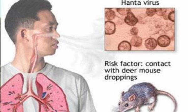 ظهور فيروس هانتا القاتل مجدداً في الصين واعراضه تشبه كورونا .. لكن كيف ينتقل؟!