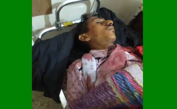 وكيل أول محافظة الحديدة: استمرار مليشيا الحوثي بقتل أبناء تهامة تحد صارخ لقرارات المجتمع الدولي